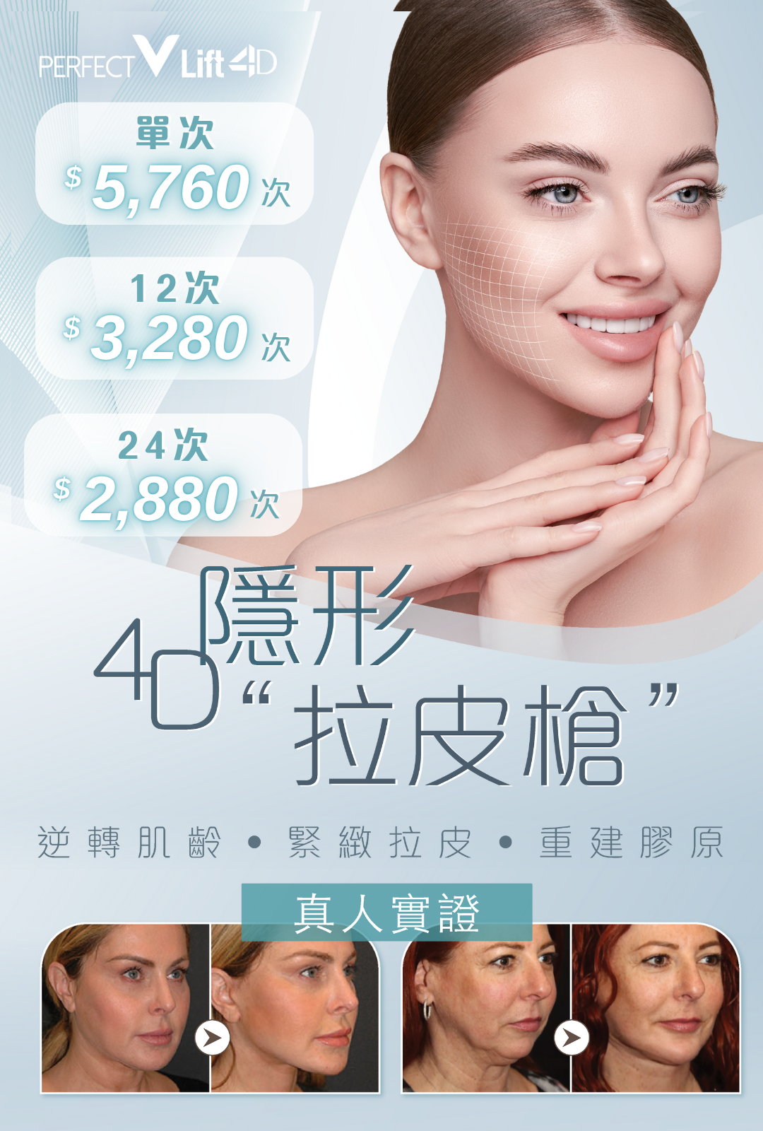 4D隱形拉皮槍